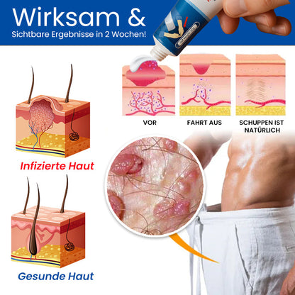 Cvreoz® HPV GentX Entlastungscreme