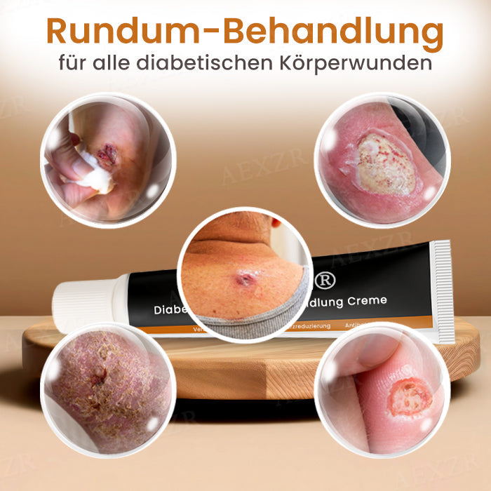 💎Heißer Verkauf! Zeitlich begrenztes Angebot Cvreoz® Diabetiker Wunden Behandlung Creme