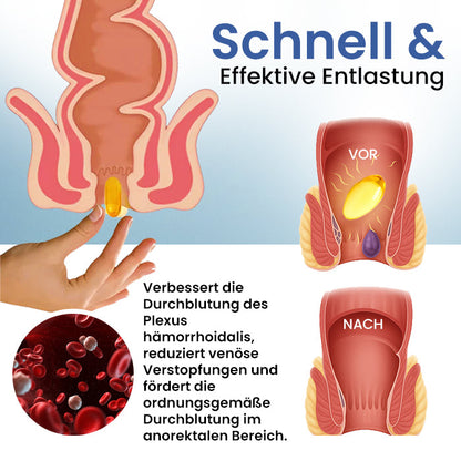 💎Heißer Verkauf! Zeitlich begrenztes Angebot  Cvreoz® Natürliche Hämorrhoiden-Kapseln