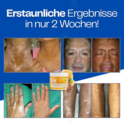 Nur noch 10 Stück übrig 🚀Cvreoz® VitiClear Bienengift Creme