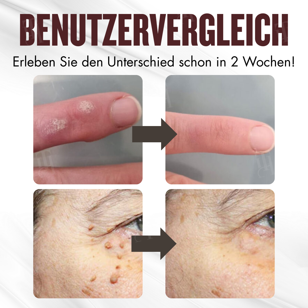 Begrenzte Stückzahl!!⚡🇩🇪𝗢𝗳𝗳𝗶𝘇𝗶𝗲𝗹𝗹𝗲𝗿 𝗦𝗵𝗼𝗽 | ⌛ RZXEA™ All-in-1 Ceramide Hautcreme(𝗡𝘂𝗿 𝗲𝗶𝗻𝗺𝗮𝗹 𝘁ä𝗴𝗹𝗶𝗰𝗵, 𝘀𝗶𝗰𝗵𝘁𝗯𝗮𝗿𝗲 𝗩𝗲𝗿ä𝗻𝗱𝗲𝗿𝘂𝗻𝗴𝗲𝗻 𝗶𝗻 𝟳 𝗧𝗮𝗴𝗲𝗻) ✅ 𝗙ü𝗿 𝗪𝗮𝗿𝘇𝗲𝗻, 𝗛𝗮𝘂𝘁𝗮𝗻𝗵ä𝗻𝗴𝘀𝗲𝗹, 𝗞𝗹𝗲𝗶𝗻𝗲 𝗕𝗲𝘂𝗹𝗲𝗻, 𝗥𝗮𝘂𝗲 𝗞𝗲𝗿𝗮𝘁𝗶𝗻𝗮𝗻𝘀𝗮𝗺𝗺𝗹𝘂𝗻𝗴𝗲𝗻 𝘂𝗻𝗱 𝗺𝗲𝗵𝗿⬇️