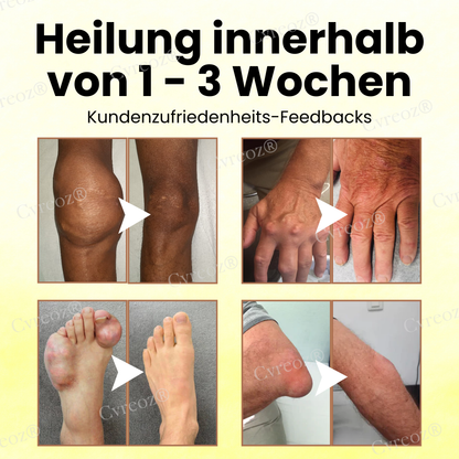 Cvreoz® Magnesiumöl & Bienengift Gelenkheilungsspray👨‍⚕️Deutsche Orthopädie Anerkannt