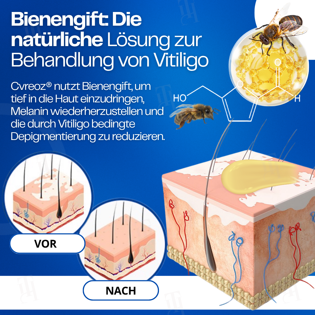 Nur noch 10 Stück übrig 🚀Cvreoz® VitiClear Bienengift Creme