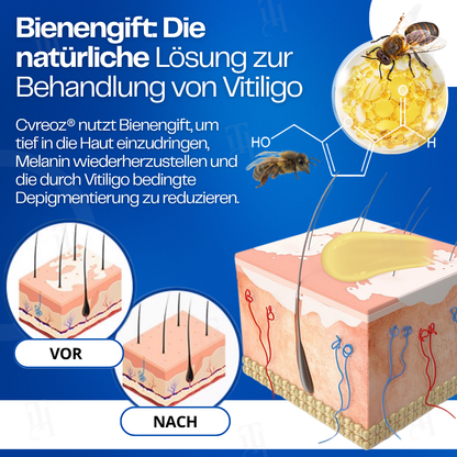 Nur noch 10 Stück übrig 🚀Cvreoz® VitiClear Bienengift Creme