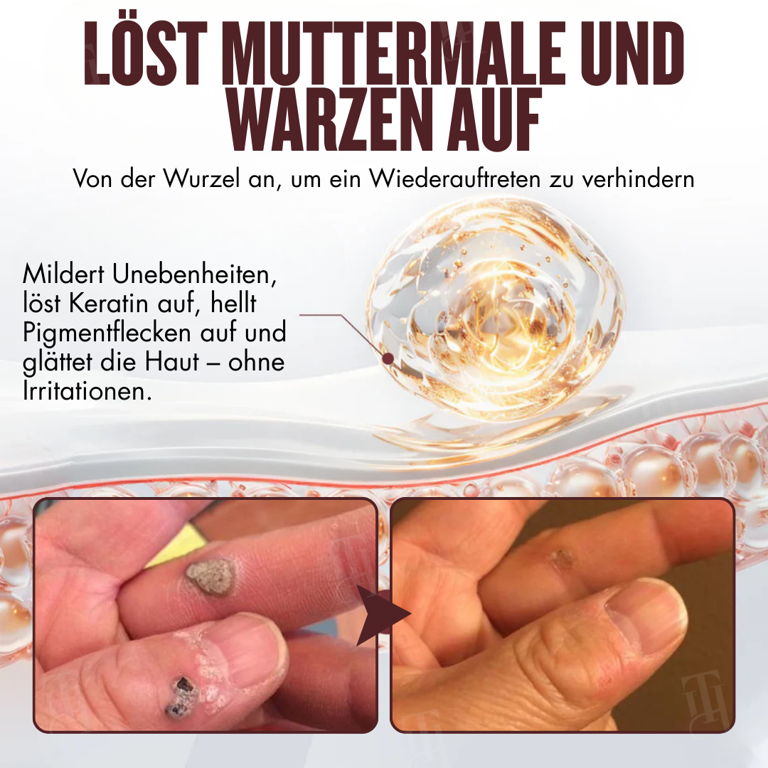 Begrenzte Stückzahl!!⚡🇩🇪𝗢𝗳𝗳𝗶𝘇𝗶𝗲𝗹𝗹𝗲𝗿 𝗦𝗵𝗼𝗽 | ⌛ RZXEA™ All-in-1 Ceramide Hautcreme(𝗡𝘂𝗿 𝗲𝗶𝗻𝗺𝗮𝗹 𝘁ä𝗴𝗹𝗶𝗰𝗵, 𝘀𝗶𝗰𝗵𝘁𝗯𝗮𝗿𝗲 𝗩𝗲𝗿ä𝗻𝗱𝗲𝗿𝘂𝗻𝗴𝗲𝗻 𝗶𝗻 𝟳 𝗧𝗮𝗴𝗲𝗻) ✅ 𝗙ü𝗿 𝗪𝗮𝗿𝘇𝗲𝗻, 𝗛𝗮𝘂𝘁𝗮𝗻𝗵ä𝗻𝗴𝘀𝗲𝗹, 𝗞𝗹𝗲𝗶𝗻𝗲 𝗕𝗲𝘂𝗹𝗲𝗻, 𝗥𝗮𝘂𝗲 𝗞𝗲𝗿𝗮𝘁𝗶𝗻𝗮𝗻𝘀𝗮𝗺𝗺𝗹𝘂𝗻𝗴𝗲𝗻 𝘂𝗻𝗱 𝗺𝗲𝗵𝗿⬇️