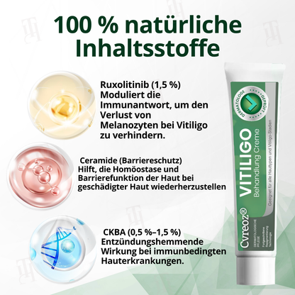 Cvreoz® Vitiligo Behandlung Creme
