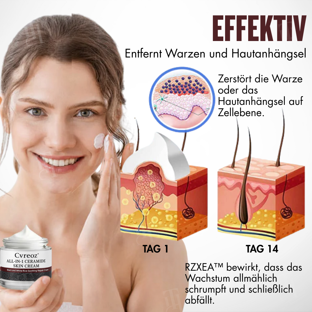 Begrenzte Stückzahl!!⚡🇩🇪𝗢𝗳𝗳𝗶𝘇𝗶𝗲𝗹𝗹𝗲𝗿 𝗦𝗵𝗼𝗽 | ⌛ RZXEA™ All-in-1 Ceramide Hautcreme(𝗡𝘂𝗿 𝗲𝗶𝗻𝗺𝗮𝗹 𝘁ä𝗴𝗹𝗶𝗰𝗵, 𝘀𝗶𝗰𝗵𝘁𝗯𝗮𝗿𝗲 𝗩𝗲𝗿ä𝗻𝗱𝗲𝗿𝘂𝗻𝗴𝗲𝗻 𝗶𝗻 𝟳 𝗧𝗮𝗴𝗲𝗻) ✅ 𝗙ü𝗿 𝗪𝗮𝗿𝘇𝗲𝗻, 𝗛𝗮𝘂𝘁𝗮𝗻𝗵ä𝗻𝗴𝘀𝗲𝗹, 𝗞𝗹𝗲𝗶𝗻𝗲 𝗕𝗲𝘂𝗹𝗲𝗻, 𝗥𝗮𝘂𝗲 𝗞𝗲𝗿𝗮𝘁𝗶𝗻𝗮𝗻𝘀𝗮𝗺𝗺𝗹𝘂𝗻𝗴𝗲𝗻 𝘂𝗻𝗱 𝗺𝗲𝗵𝗿⬇️