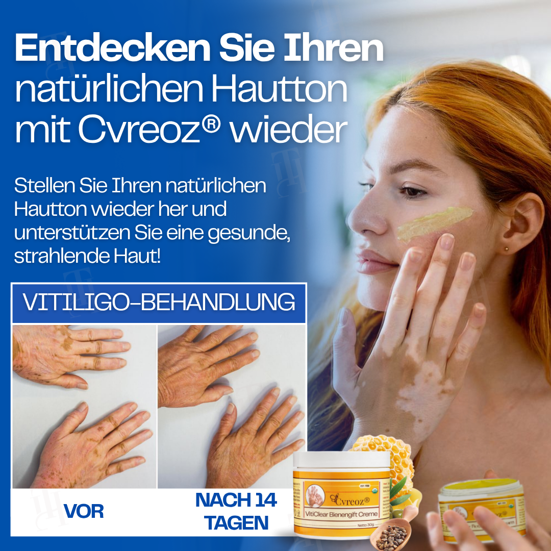 Nur noch 10 Stück übrig 🚀Cvreoz® VitiClear Bienengift Creme