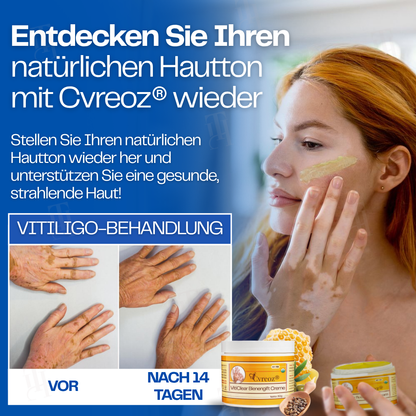 Nur noch 10 Stück übrig 🚀Cvreoz® VitiClear Bienengift Creme
