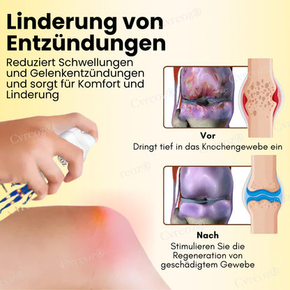 Cvreoz® Magnesiumöl & Bienengift Gelenkheilungsspray👨‍⚕️Deutsche Orthopädie Anerkannt