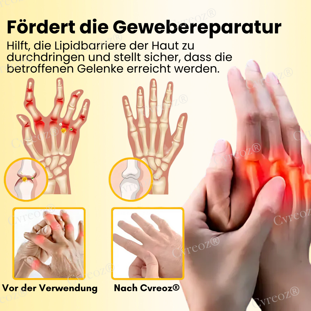Cvreoz® Magnesiumöl & Bienengift Gelenkheilungsspray👨‍⚕️Deutsche Orthopädie Anerkannt