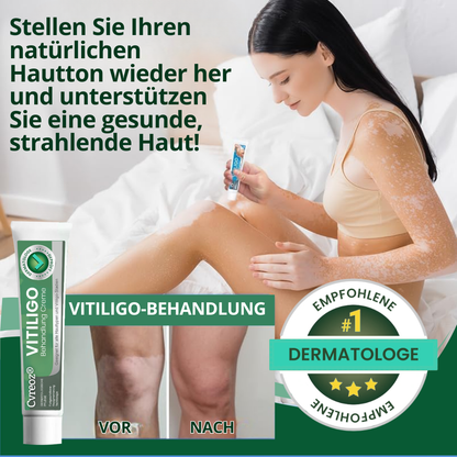 Cvreoz® Vitiligo Behandlung Creme