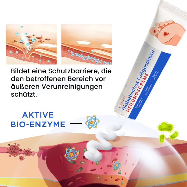 Cvreoz® Diabetisches Fußgeschwür  Heilungscreme✔𝐬𝐢𝐜𝐡𝐭𝐛𝐚𝐫𝐞 𝐕𝐞𝐫𝐛𝐞𝐬𝐬𝐞𝐫𝐮𝐧𝐠 𝐢𝐧 𝟐-𝟑 𝐖𝐨𝐜𝐡𝐞𝐧✔